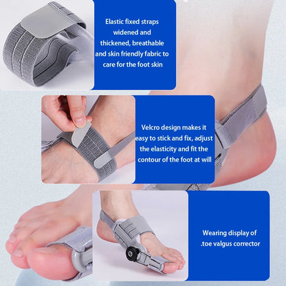 Align - Pijnlijke Bunion? Corrigeer & Verlicht met de Verstelbare Teenseparator!