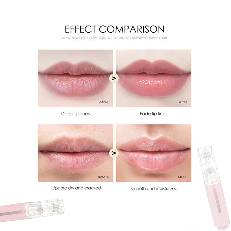 Weg met dunne lippen! - Actieve Micro Roller