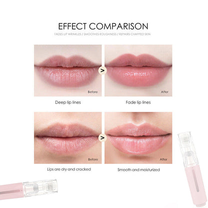 Weg met dunne lippen! - Actieve Micro Roller